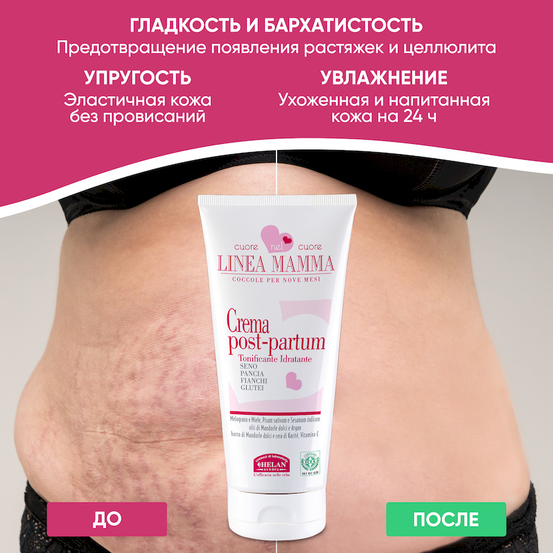 Крем для восстановл. фигуры после родов (Linea Mamma) - 150 мл. Фото №8